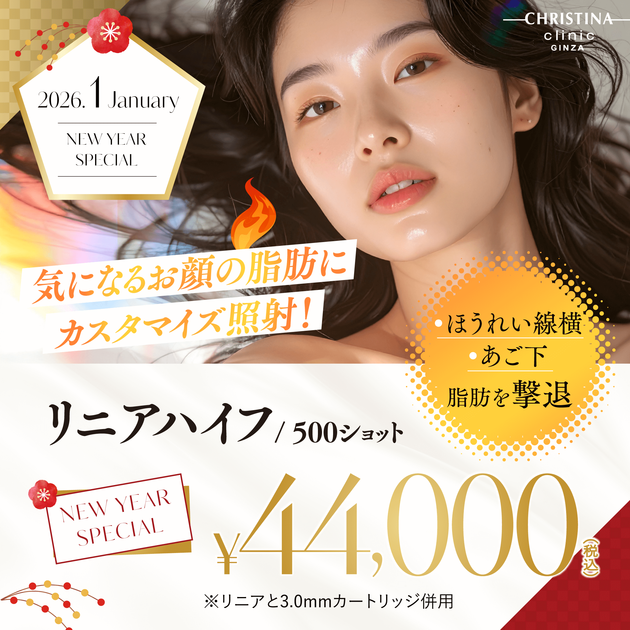 気になるお顔の脂肪にカスタマイズ照射！　ほうれい線横・あご下・脂肪を撃退　リニアハイフ