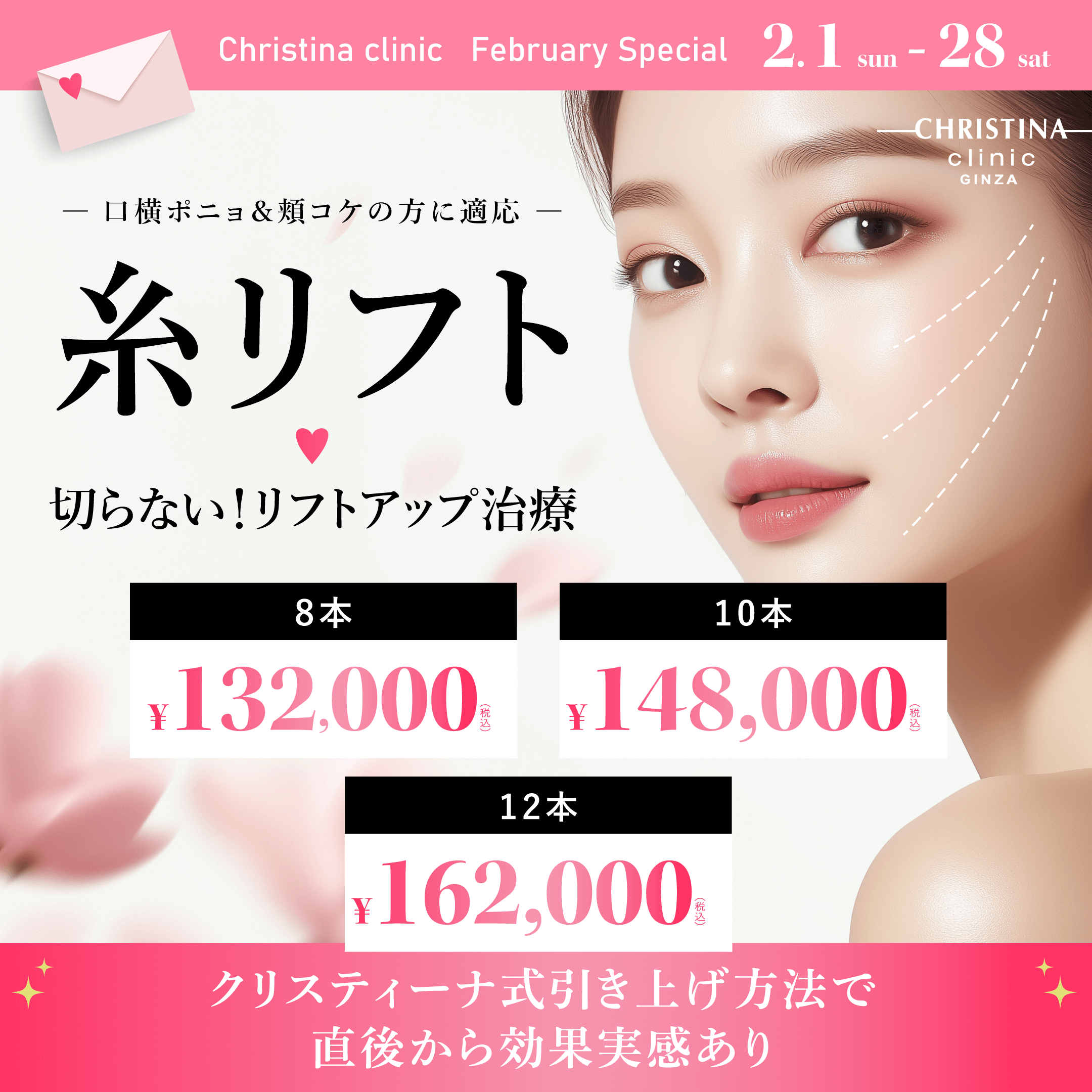 口横ポニョ＆頬コケの方に適応　糸リフト　切らない！リフトアップ治療　クリスティーナ式引き上げ方法で直後から効果実感あり