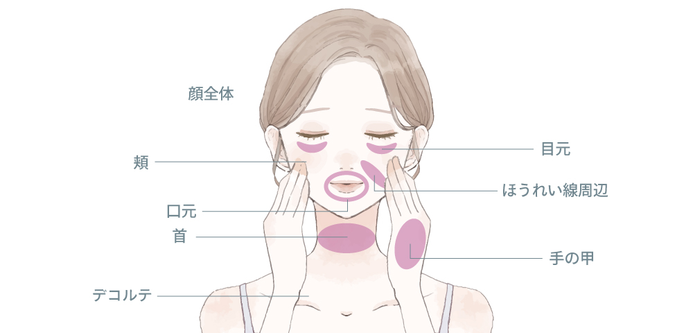 ボライトXCの適応箇所